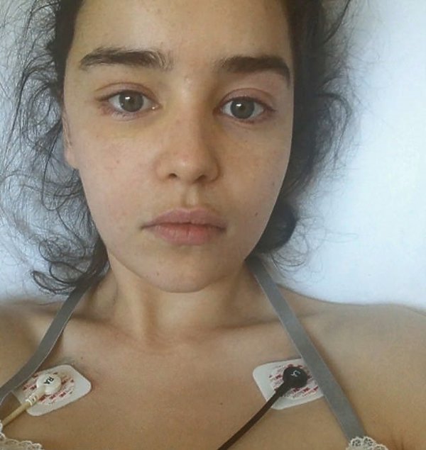 Emilia Clarke w szpitalu