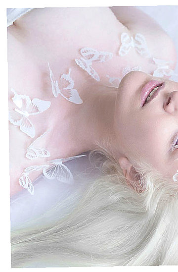 Zdjęcia albinosów
